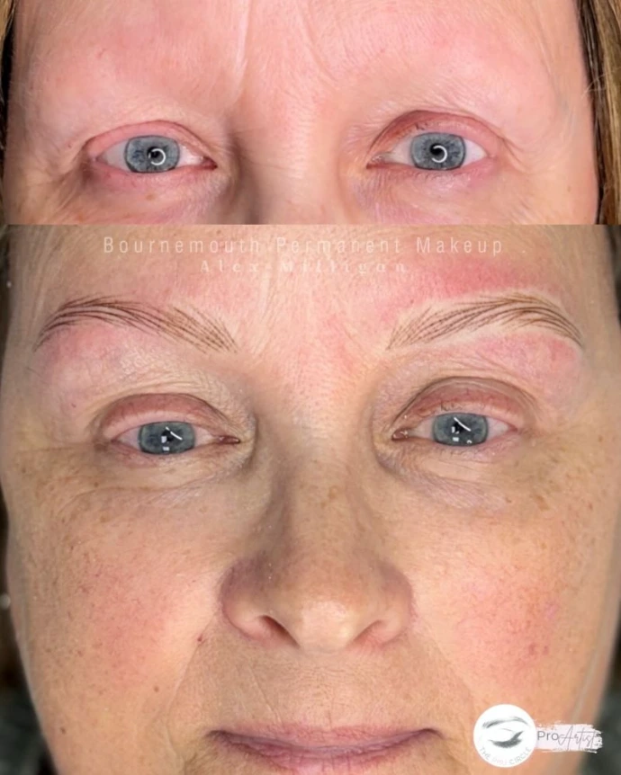 hyperrealism brows for alopecia client near Bournemouth